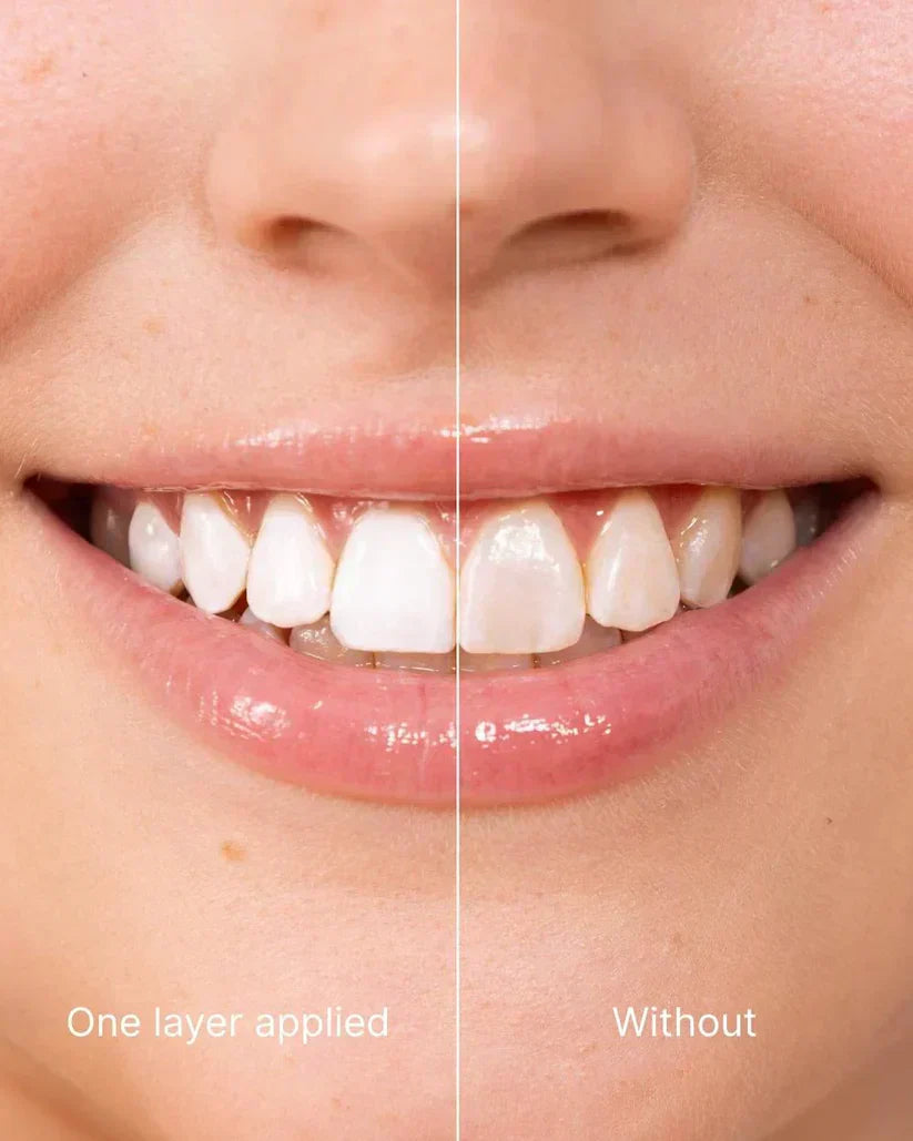 ⏰ Final 4 Hours: 70% OFF | Misspone© Tooth Polish - Instant Clean Smile
