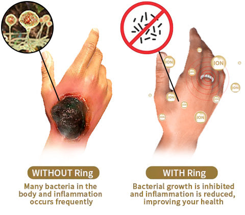 (đ CHRISTMAS SALE - 80% OFF! đĽLAST DAY!) DIYSTAR⢠Lymphatic Magnetic Therapy Diamond Ring