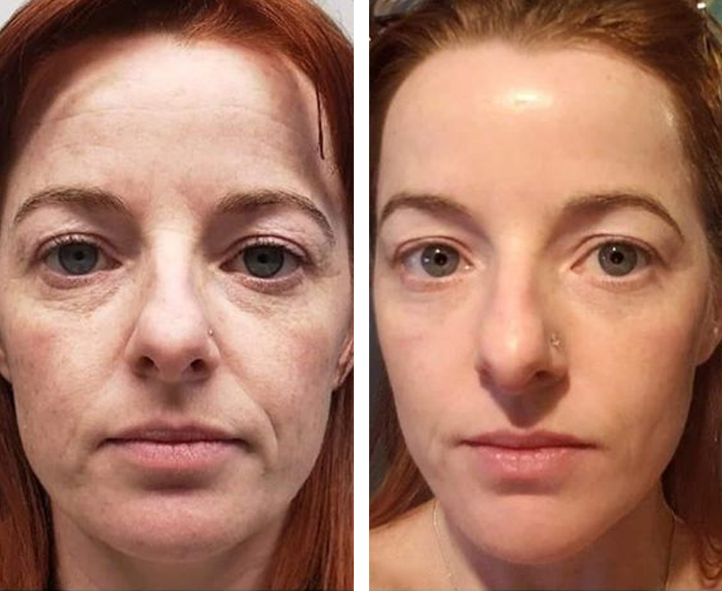 โจ๐๐๐ฌ๐ญ ๐๐๐ฒ ๐๐ข๐ฌ๐๐จ๐ฎ๐ง๐ญ: 70% ๐๐
๐
๐ธInstant Wrinkle Eraser: Restore Skin Elasticityโญ
