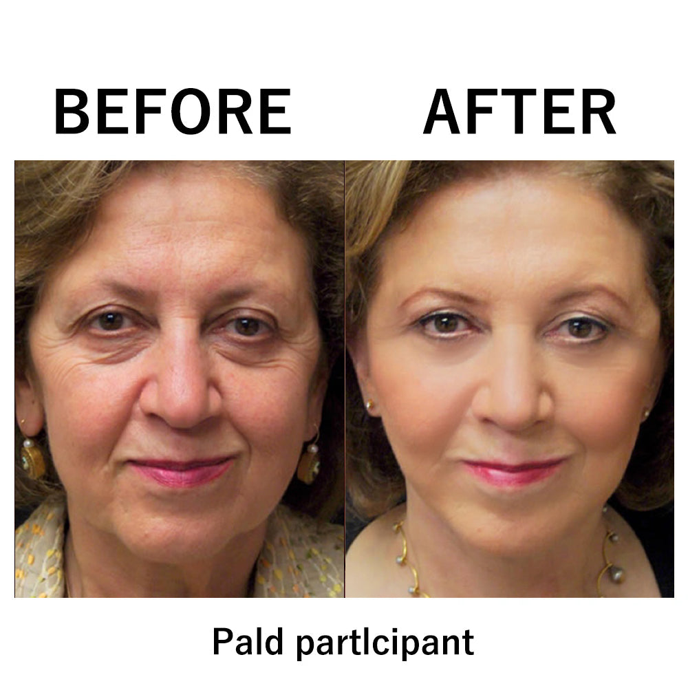🔥Early Xmas Sales 🎅 Last Day Discount: 87% OFF 🌸Instant Wrinkle Eye Tightener cream