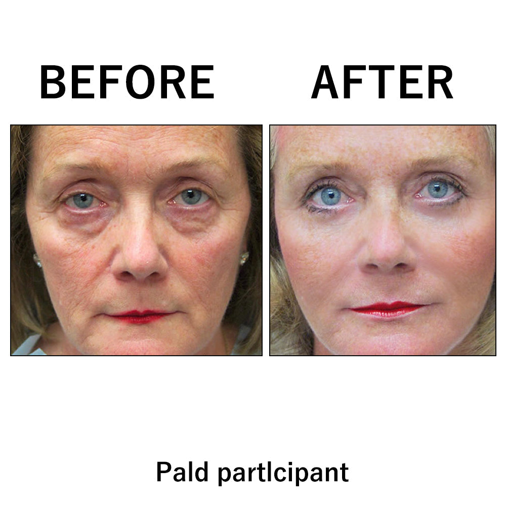 🔥Early Xmas Sales 🎅 Last Day Discount: 87% OFF 🌸Instant Wrinkle Eye Tightener cream