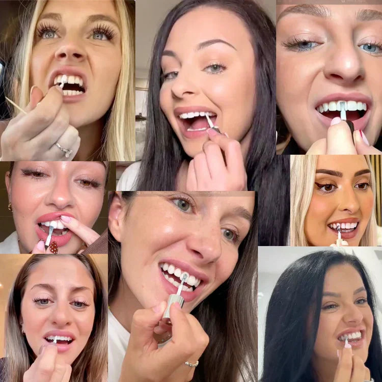 ⏰ Final 4 Hours: 70% OFF | Misspone© Tooth Polish - Instant Clean Smile
