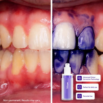 Vitae Teeth Whitening Colour Corrector Serum 30ml