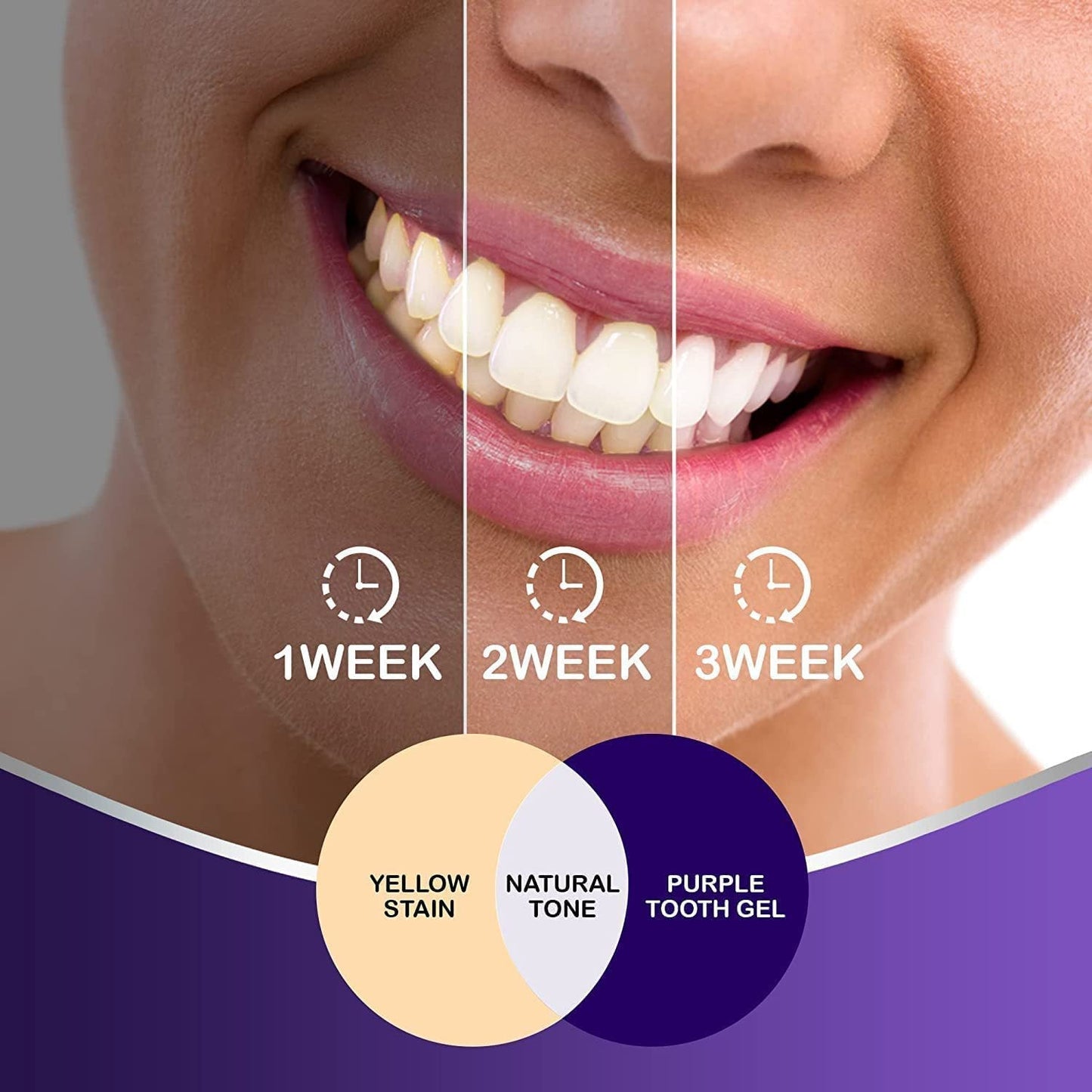 Vitae Teeth Whitening Colour Corrector Serum 30ml